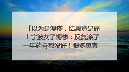 以为是湿疹，结果竟是癌！宁波女子悔惨：反复涂了一年药膏都没好！很多患者首诊都去了皮肤科