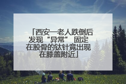 西安一老人跌倒后发现“异常” 固定在股骨的钛针竟出现在膝盖附近
